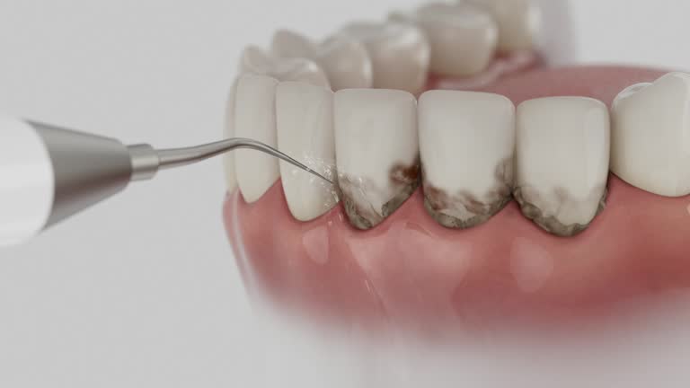 Trusted Emergency Dentist service in Somerset, MD - Dentist Open Now